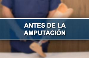 Antes Amputaci�n