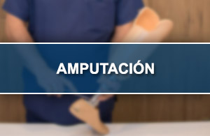 Amputaci�n