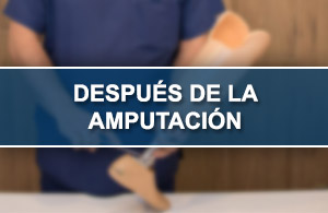 Despu�s Amputaci�n