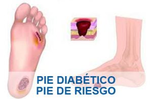 Pie Diab�tico