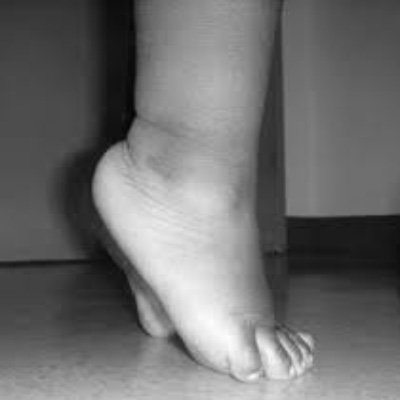 Podolog�a Infantil